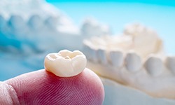 A closeup of a tooth-colored dental crown on a person’s finger