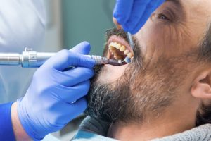 man in dental chair teeth cleaned